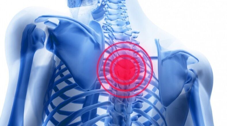 durerile de spate se pot datora unei hernii de disc