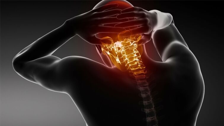 durere în partea din spate a capului cu osteocondroză cervicală